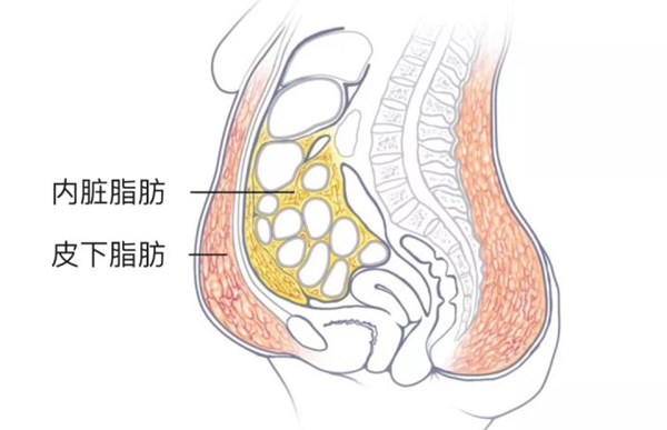 内脏脂肪和皮下脂肪对比.jpg 内脏脂肪和皮下脂肪对比.jpg
